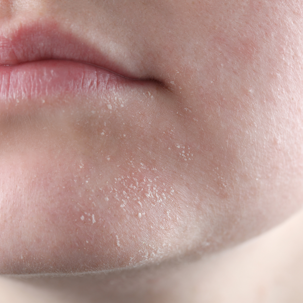 The Gentle, Effective Solution for Dry, Irritated Skin