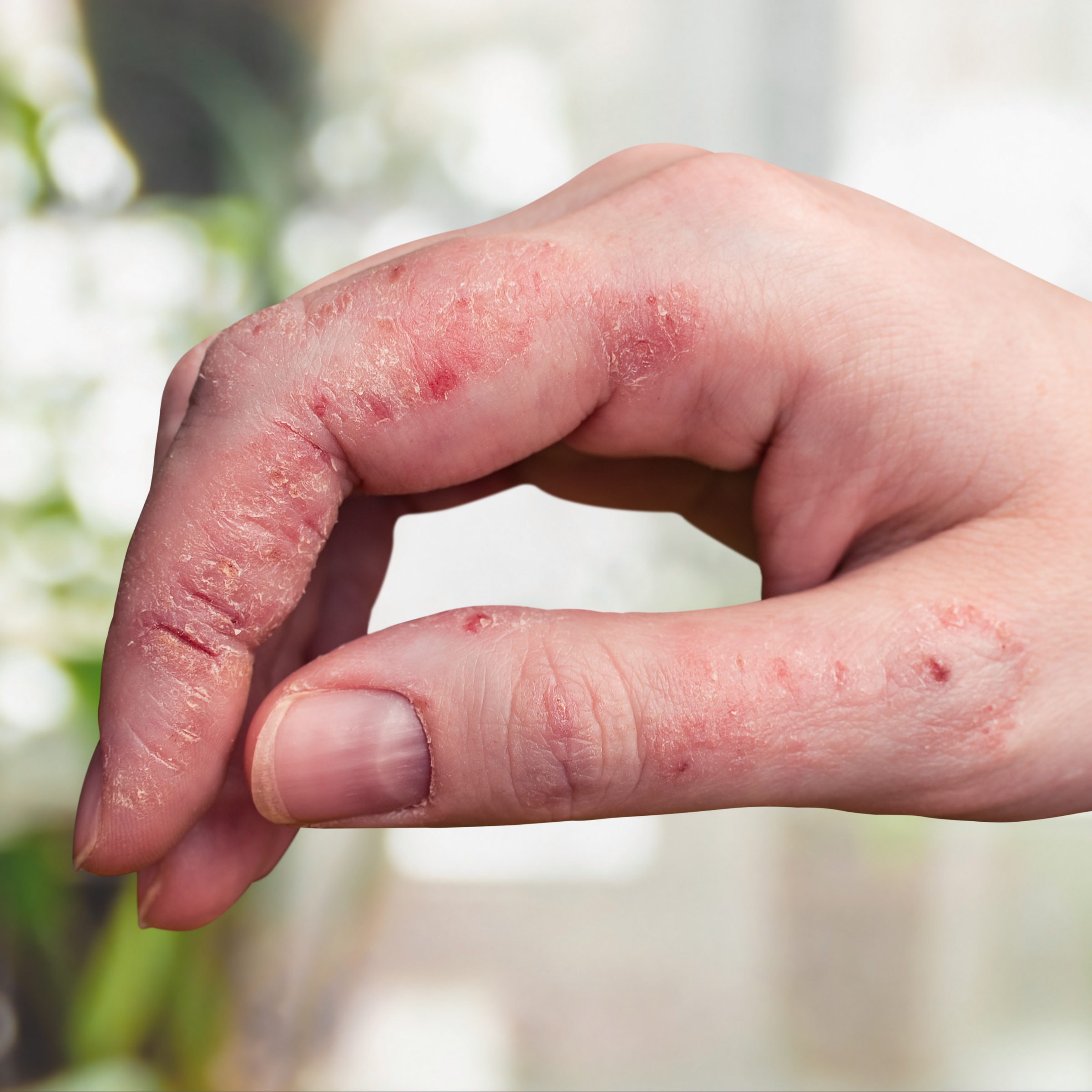 Shop The Bundle- SAVE 20% On Our Best Sellers For Dry, Itchy & Sensitive Skin